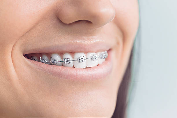 Best Root Canal Treatment  in Carlyss, LA